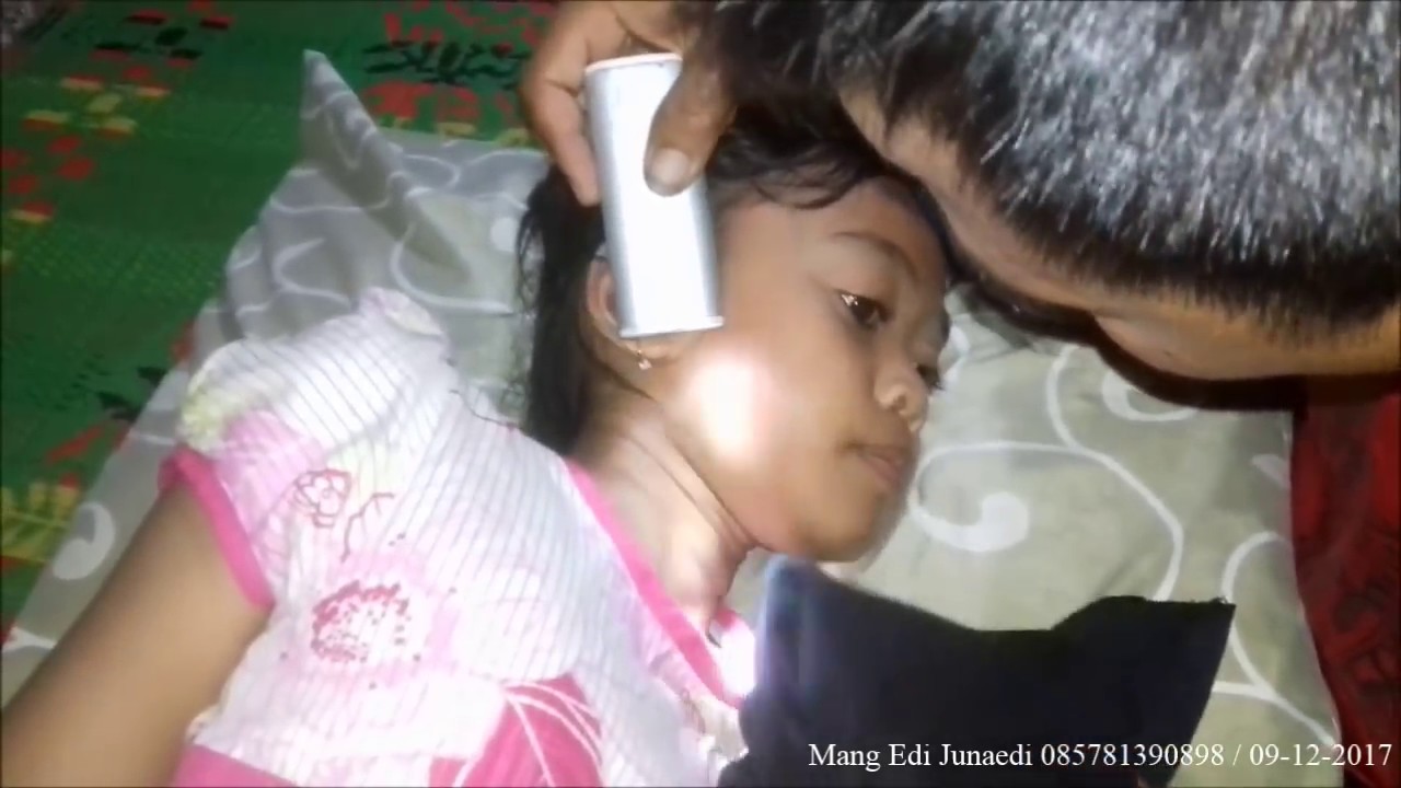 Ulat Sakit Gigi - YouTube