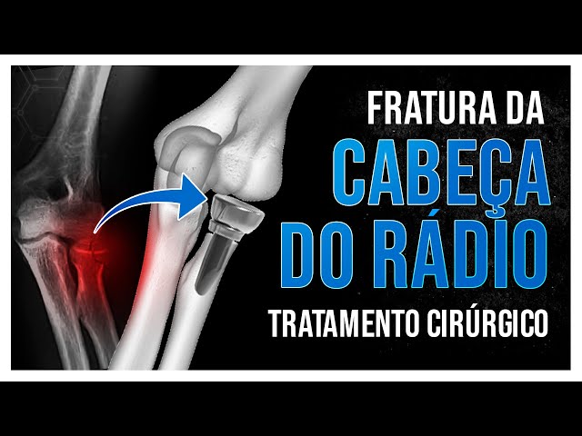 Rádio Cabeça