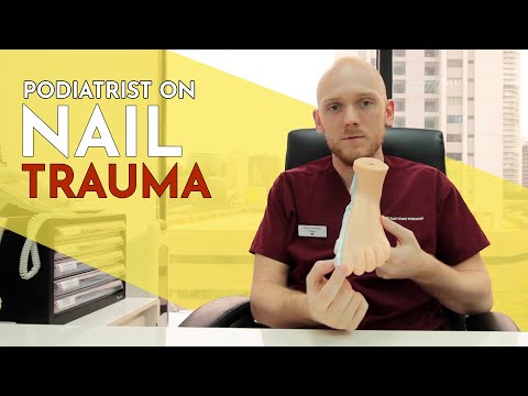 Treating Nail Trauma - Podiatrist Elliott Yeldham, Singapore Podiatry