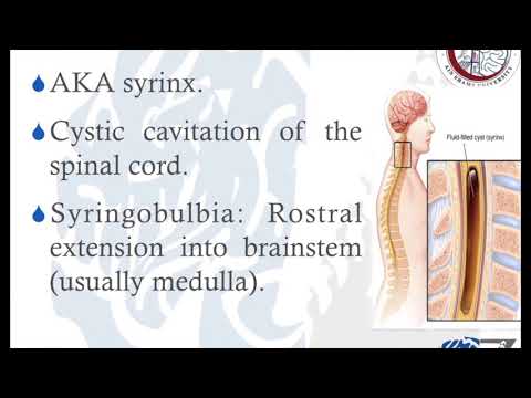   1 تكيس النخاع الشوكي