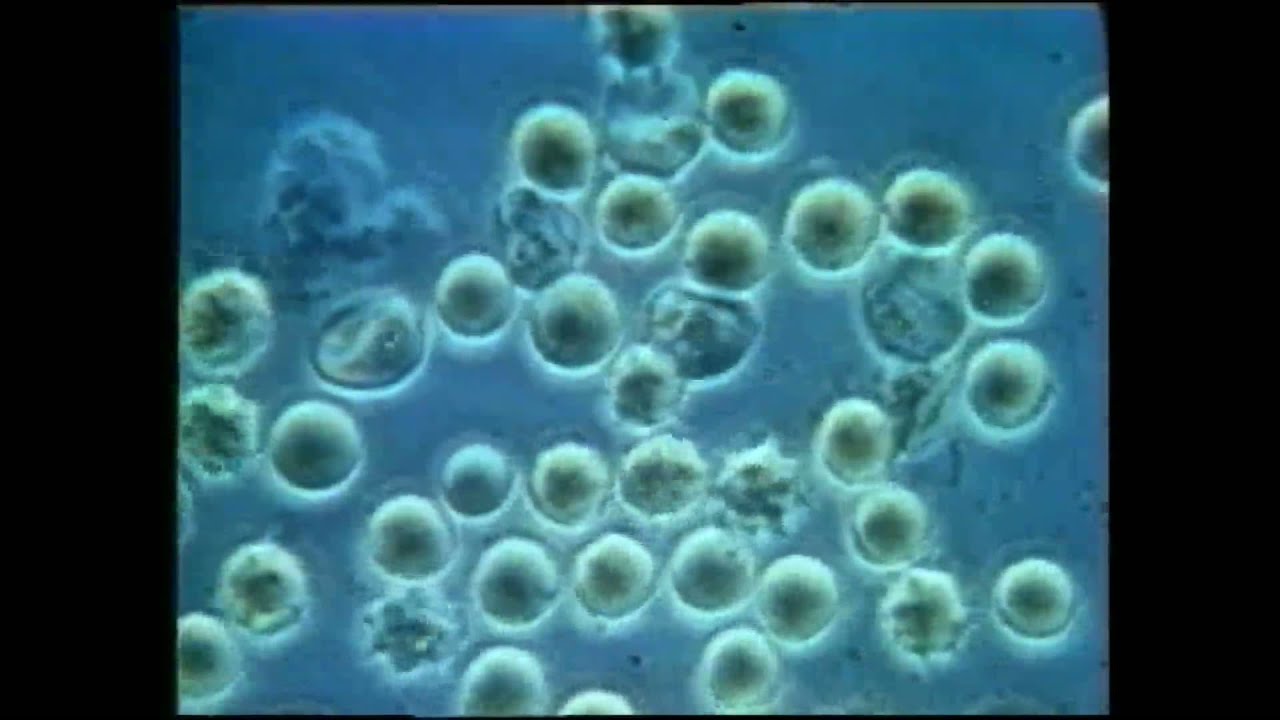 Reportage | Vivre avec le paludisme