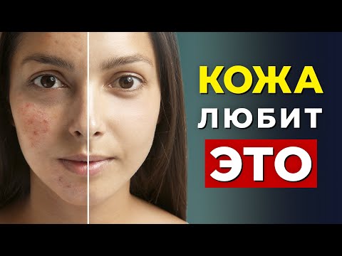 15 Лучших Продуктов Для Сияющей Кожи. (Витамины для здоровья кожи)