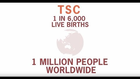 TSC and Seizures: Did You Know?