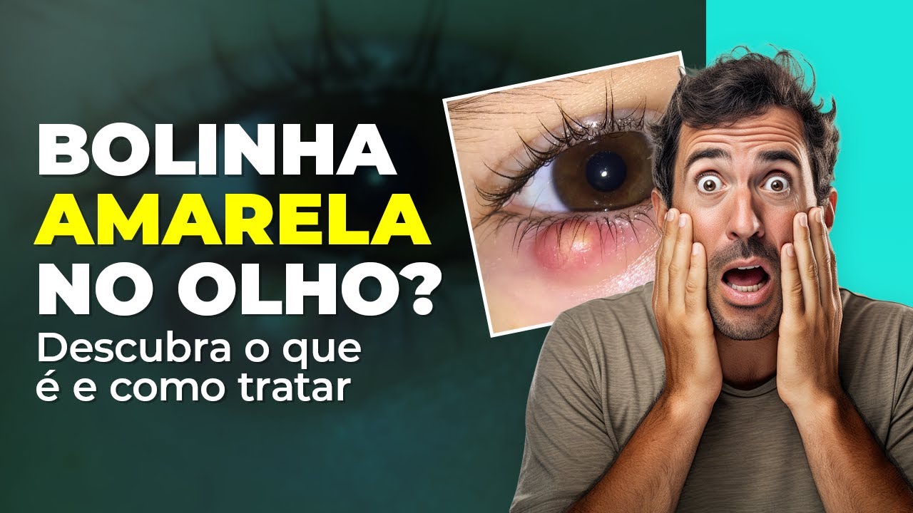 Descubra como tratar o Terçol em casa | Bolinha amarela no olho | Dr ...