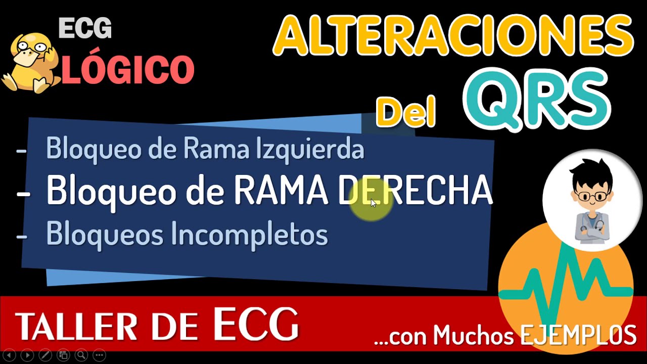 famoso Pinchazo Desacuerdo BLOQUEO completo e incompleto DE RAMA DERECHA, BCRD, CASO CLINICO,  EJERCICIOS - YouTube