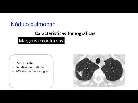 Vídeo: Rendimento Diagnóstico E Análise De Risco / Benefício Da Criobiopsia Pulmonar Trans-brônquica Em Doenças Pulmonares Parenquimatosas Difusas: Uma Grande Coorte De 699 Pacientes