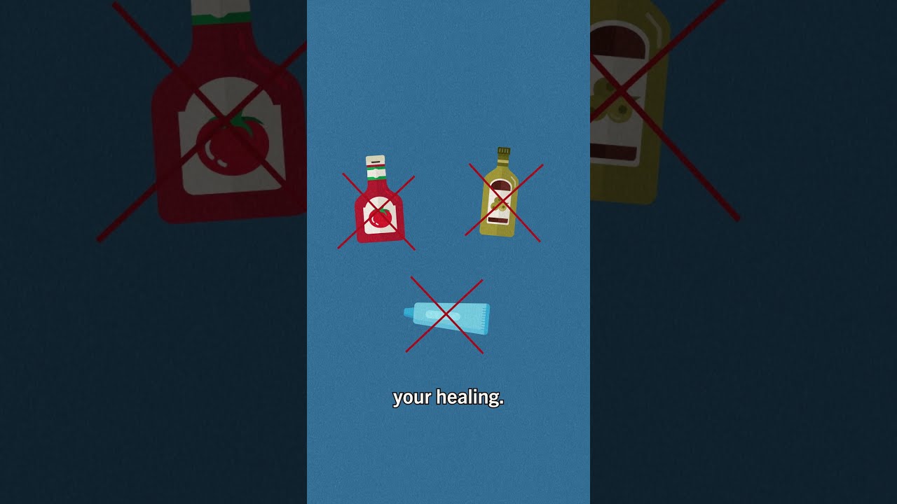 What S The First Thing You Should Do To Treat A Burn 