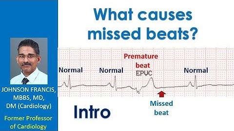 What causes missed beats? - Intro