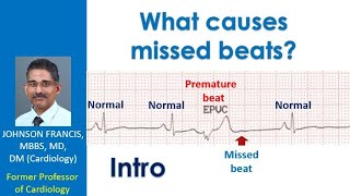 What causes missed beats? - Intro