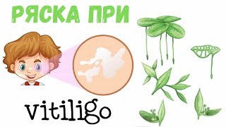 Ряска от витилиго, лечебные свойства, как применять.