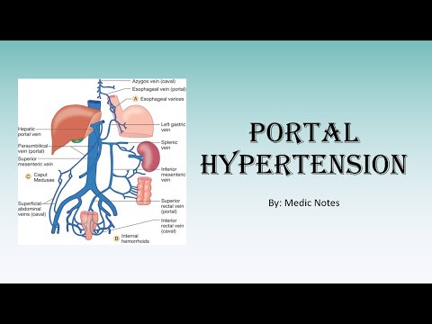 Portal hypertension - definition, causes, investigation findings, treatment, complication