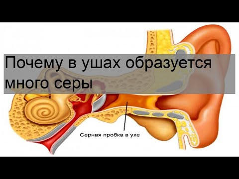 Почему в ушах образуется много серы