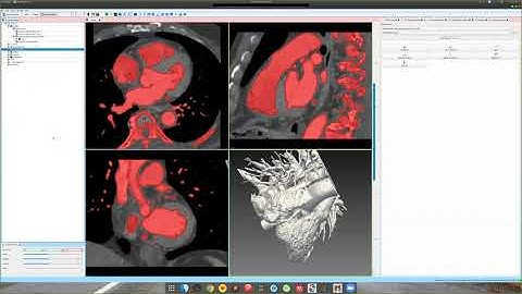SimVascular Tutorial 16: 3D Segmentation
