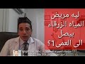 ليه مريض المياه الزرقاء بيصل الى العمى 1