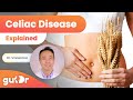 Celiac Disease Explained | 3D Gut Animation