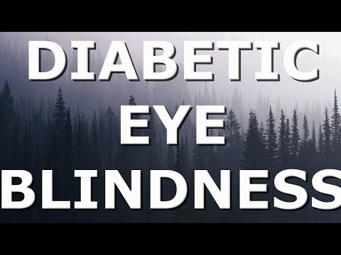 shocking-diabetic-eye-diseases---retinopathy,-glaucoma,-cataracts