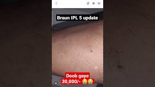 Braun IPL 5 results will disappoint 😞 screenshot 4