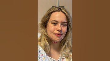 Don’t do double jaw surgery