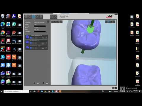VHF SOFTWARE DENTAL