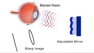 Astronomy Tool Detects Eye Diseases Earlier