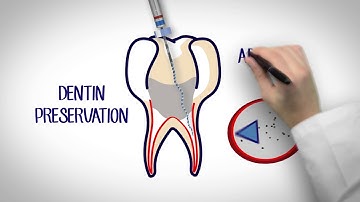 Video fkg xp endo shaper whiteboard full hd