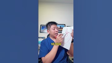 Có nên phẫu thuật để điều trị trào ngược dạ dày không? | Dr Ngọc #short #shrots #drngoc