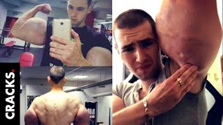 Popeye Ruso Revela Por Qué Puso Sus Brazos De Esa Bestial Manera