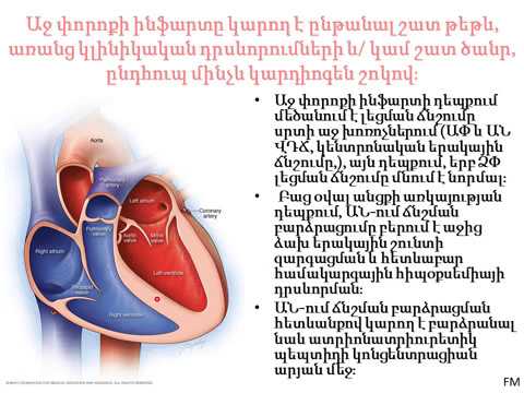 Video: Ի՞նչ է վանկոմիցինի ներարկումը: