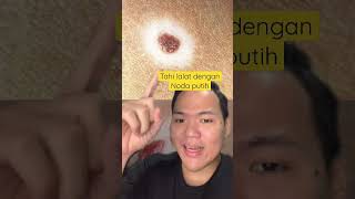 [PART 2] Arti tanda lahir dengan kehidupan masa lalu ‼️😱 #Shorts #YouTubePartner