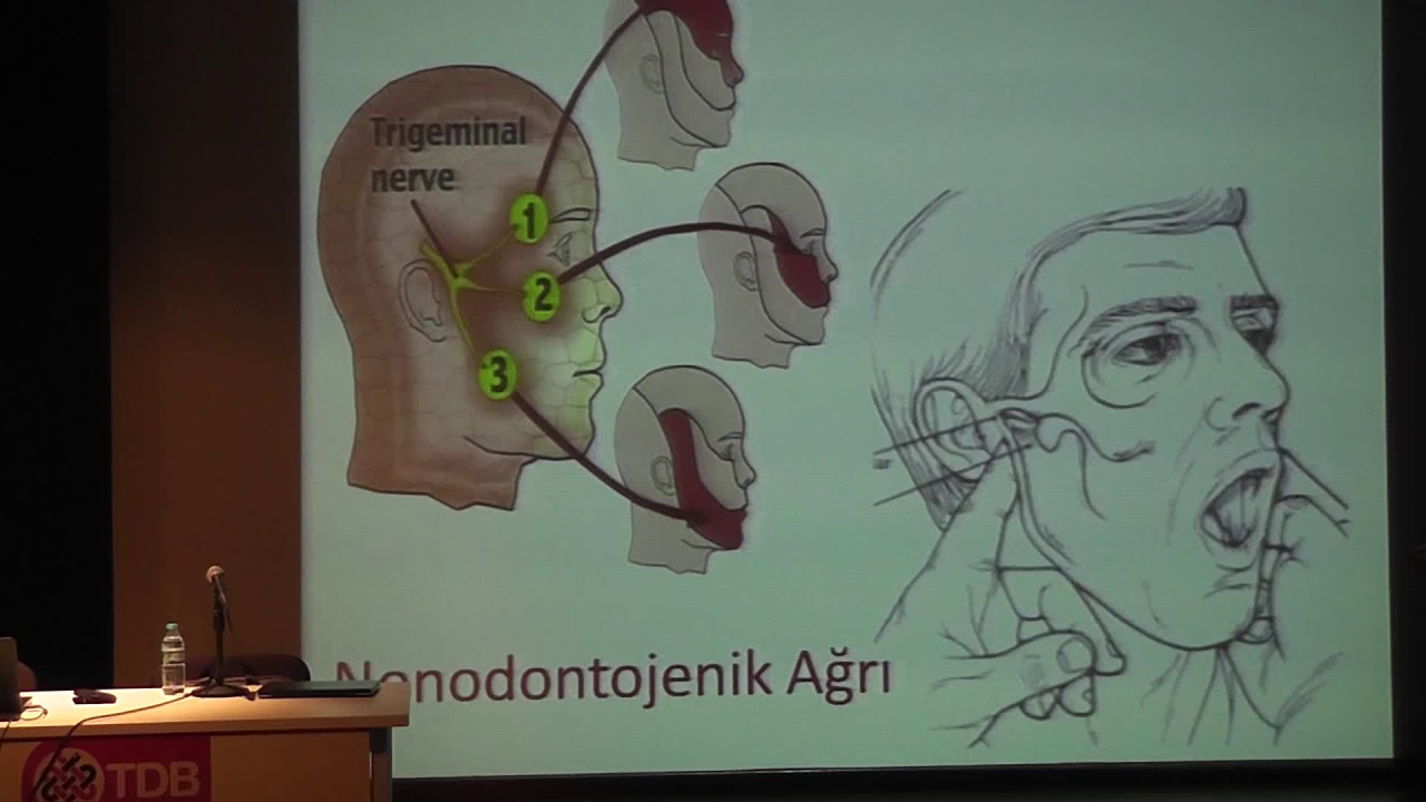 Endodontik Tedavide Ağrıyı Etkileyen Faktörler -  Dr. Öğr. Üyesi Ayfer Atav Ateş