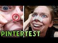 PINTERTEST- Bobbypins VS Blackheads?