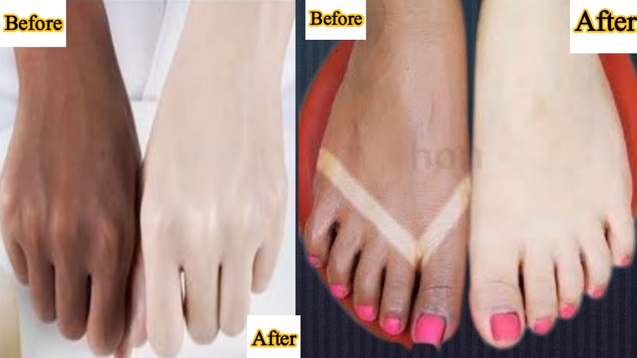 Get Beautiful, Soft, Whiten And Glowing Hands & Feet Wonderful Home