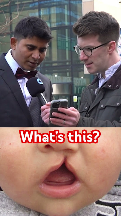 What is this deformity of the lip called? #shorts