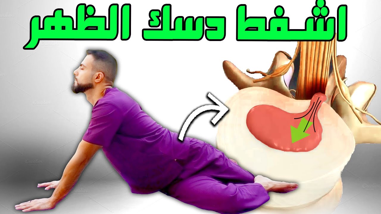 علاج شفط الدسك والانزلاق الغضروفي لمكانه الطبيعي || علاج ألم تنميل خدر الرجل