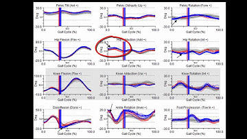 3D running biomechanics at Melbourne Sports & Allied Health Clinic