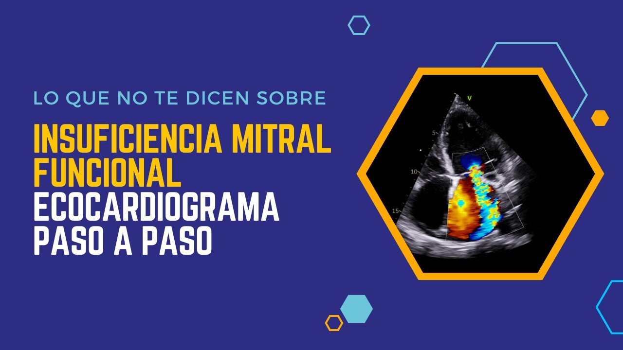 ✅INSUFICIENCIA MITRAL: Ecocardiograma Paso a Paso🚀
