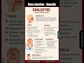 Sinusitis - Sinus Infection #sinusinfection #sinus #sinusitis