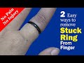 How to remove stuck ring from finger  no pain and injury  2 effective tricks