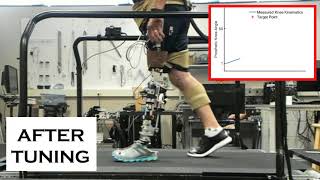 Impedance Tuning Of A Robotic Prosthesis