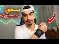 يدي مكسورة بسبب فري فاير