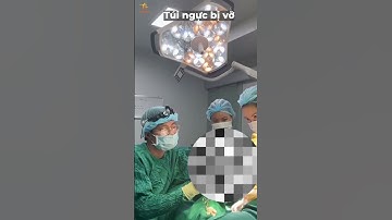 SAU KHI NÂNG NGỰC, KHI NÀO CẦN THAY TÚI NGỰC? #viral #bsthangle #xuhuong #pttm #nângngực #tuinguc