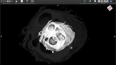 Rapid construction of 3D STL data for a 3D heart model.