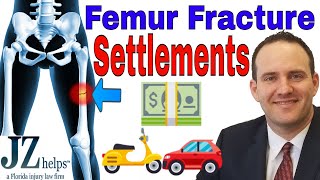 Femur (Upper Leg) Fracture Settlements from Car Accidents and More
