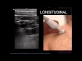 Tutorial Ultrasound Guided Subclavian Line