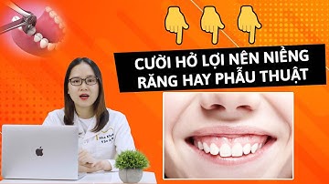 Cười hở lợi nên niềng răng hay phẫu thuật