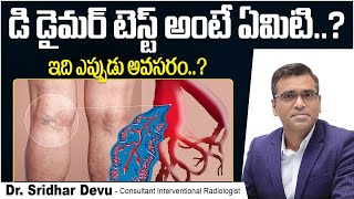 డి-డైమ‌ర్ టెస్టు || Diagnosis of Deep Vein Thrombosis || Blood Clot in Legs | D-Dimer Test | Dr Devu