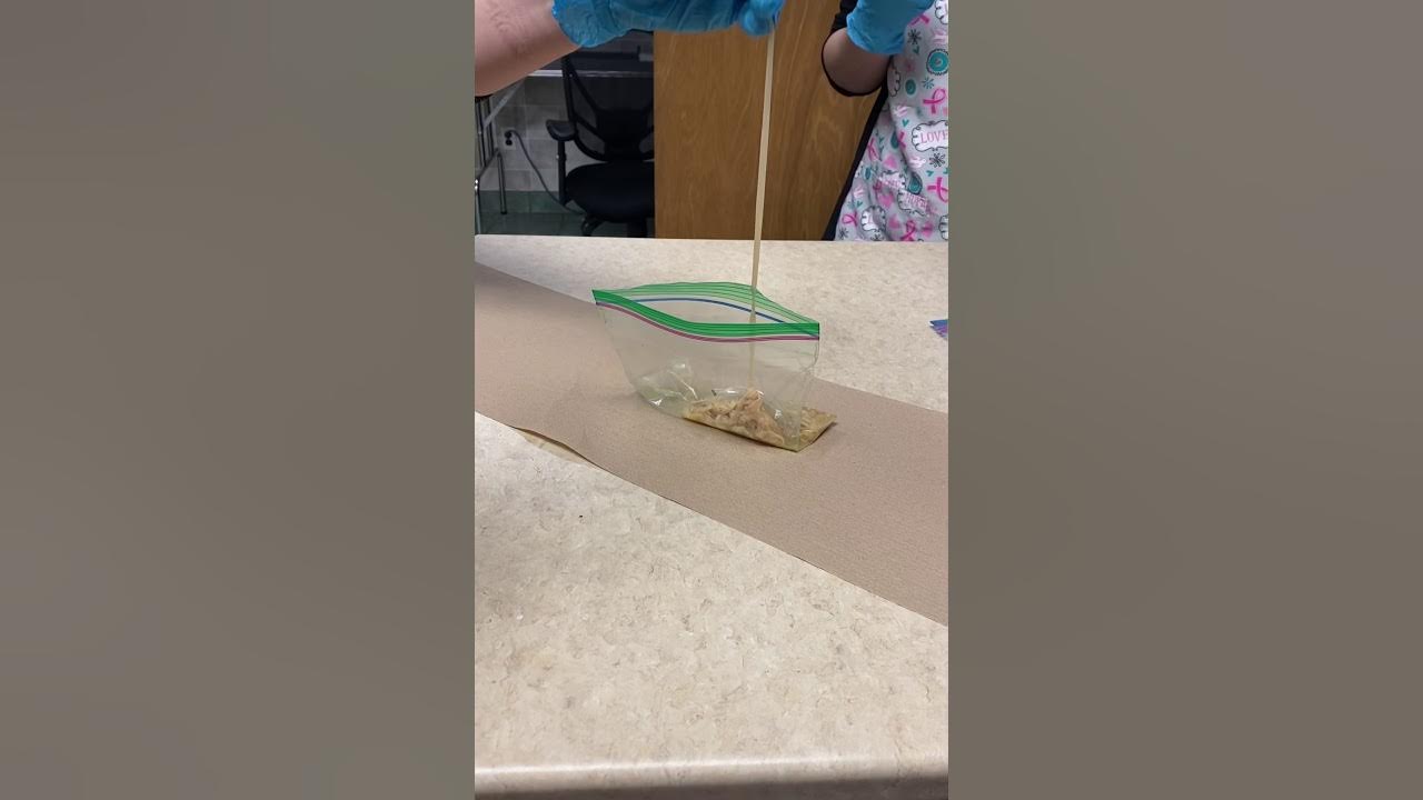 Fish Tapeworm (Diphyllobothrium latum) YouTube