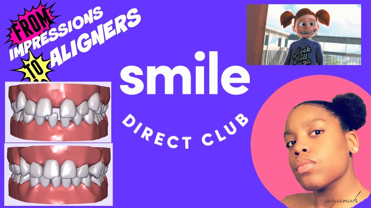 SMILE DIRECT CLUB! THE WHOLE PROCESS (DETAILED) YouTube