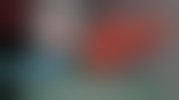 Right Hepatectomy for a Large Right Lobe Hepatocellular Carcinoma  | Dr Hitesh Chavda