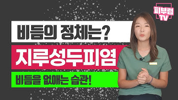 비듬의 정체는? 지루성 두피염 !! 집에서 비듬을 없애는 방법에 대해서 알려드립니다.
